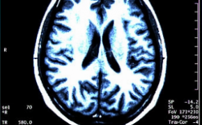rewind-therapeutics-pmv